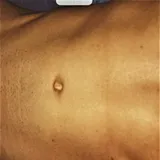 baddmark