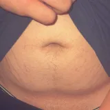 Sugar belly